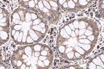 NRAS Antibody in Immunohistochemistry (Paraffin) (IHC (P))