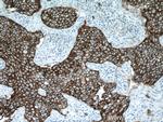 HER2/ErbB2 Antibody in Immunohistochemistry (Paraffin) (IHC (P))