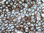 HER2/ErbB2 Antibody in Immunohistochemistry (Paraffin) (IHC (P))