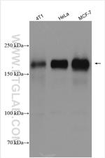 HER2/ErbB2 Antibody in Western Blot (WB)