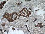 HER2/ErbB2 Antibody in Immunohistochemistry (Paraffin) (IHC (P))