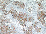 HER2/ErbB2 Antibody in Immunohistochemistry (Paraffin) (IHC (P))