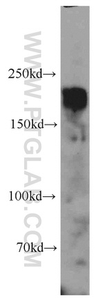 HER2/ErbB2 Antibody in Western Blot (WB)