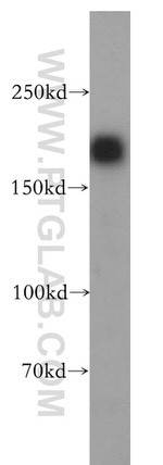 HER2/ErbB2 Antibody in Western Blot (WB)