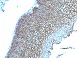 Desmoglein-3 Antibody in Immunohistochemistry (Paraffin) (IHC (P))