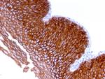 Desmoglein-3 Antibody in Immunohistochemistry (Paraffin) (IHC (P))