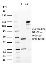 Desmoglein-3 Antibody in SDS-PAGE (SDS-PAGE)