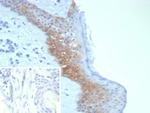 Desmoglein-3 (Squamous Cell Marker) Antibody in Immunohistochemistry (Paraffin) (IHC (P))