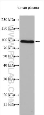 Plasminogen Antibody in Western Blot (WB)