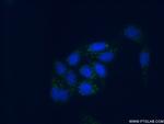 Plasminogen Antibody in Immunocytochemistry (ICC/IF)