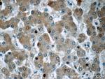 Plasminogen Antibody in Immunohistochemistry (Paraffin) (IHC (P))