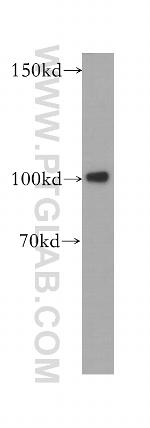 Plasminogen Antibody in Western Blot (WB)