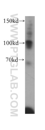 Plasminogen Antibody in Western Blot (WB)