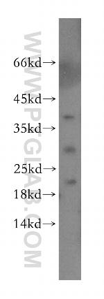 Endostatin Antibody in Western Blot (WB)