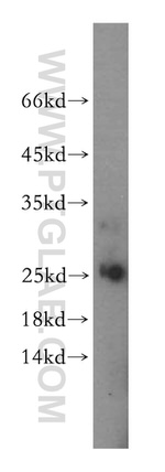 Endostatin Antibody in Western Blot (WB)