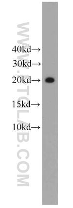 Angiogenin Antibody in Western Blot (WB)