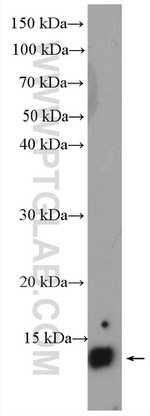 Angiogenin Antibody in Western Blot (WB)