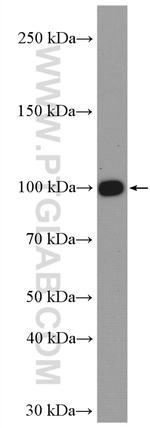 Integrin beta-3 Antibody in Western Blot (WB)