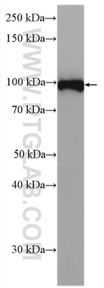 Integrin beta-3 Antibody in Western Blot (WB)