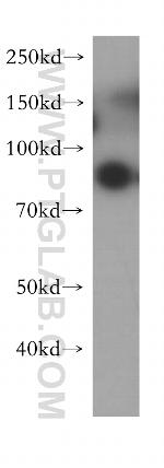 G-CSFR Antibody in Western Blot (WB)