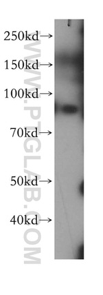 G-CSFR Antibody in Western Blot (WB)