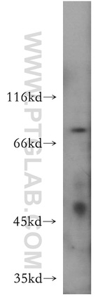 NHE8 Antibody in Western Blot (WB)