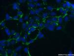 NHE8 Antibody in Immunocytochemistry (ICC/IF)