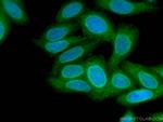 MAD1 Antibody in Immunocytochemistry (ICC/IF)