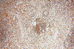 MAD1 Antibody in Immunohistochemistry (Paraffin) (IHC (P))