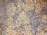 MAD1 Antibody in Immunohistochemistry (Paraffin) (IHC (P))