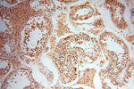 MAD1 Antibody in Immunohistochemistry (Paraffin) (IHC (P))