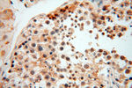 MAD1 Antibody in Immunohistochemistry (Paraffin) (IHC (P))