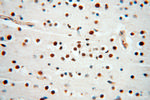 MAD1 Antibody in Immunohistochemistry (Paraffin) (IHC (P))