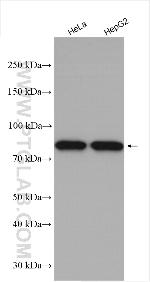 MAD1 Antibody in Western Blot (WB)