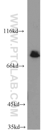 MAD1 Antibody in Western Blot (WB)