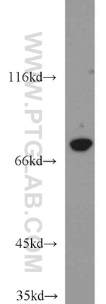 MAD1 Antibody in Western Blot (WB)