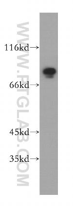 MAD1 Antibody in Western Blot (WB)