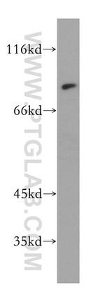 MAD1 Antibody in Western Blot (WB)