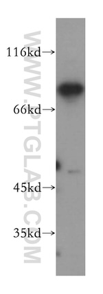 MAD1 Antibody in Western Blot (WB)