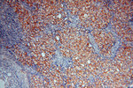 DEAF1 Antibody in Immunohistochemistry (Paraffin) (IHC (P))