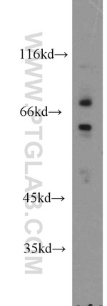 DEAF1 Antibody in Western Blot (WB)