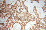 SSH3 Antibody in Immunohistochemistry (Paraffin) (IHC (P))