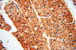 SSH3 Antibody in Immunohistochemistry (Paraffin) (IHC (P))