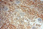 SSH3 Antibody in Immunohistochemistry (Paraffin) (IHC (P))