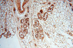 SSH3 Antibody in Immunohistochemistry (Paraffin) (IHC (P))