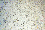 SSH3 Antibody in Immunohistochemistry (Paraffin) (IHC (P))