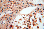 SSH3 Antibody in Immunohistochemistry (Paraffin) (IHC (P))