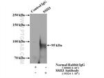 SSH3 Antibody in Immunoprecipitation (IP)