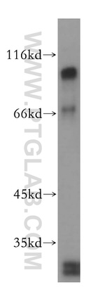 SSH3 Antibody in Western Blot (WB)