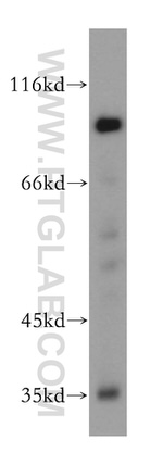 SSH3 Antibody in Western Blot (WB)